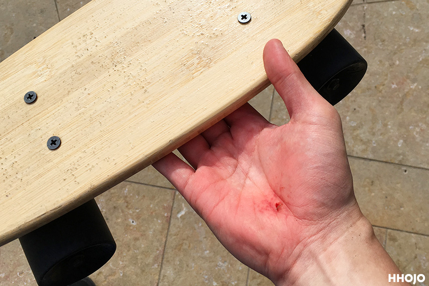 day4_skate_injury_img